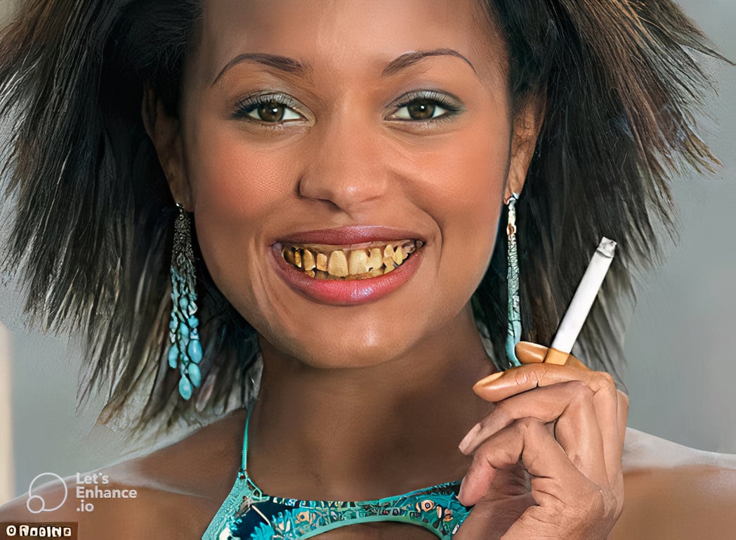 Cost of Cigarettes? Read More About Effects of Smoking on Teeth