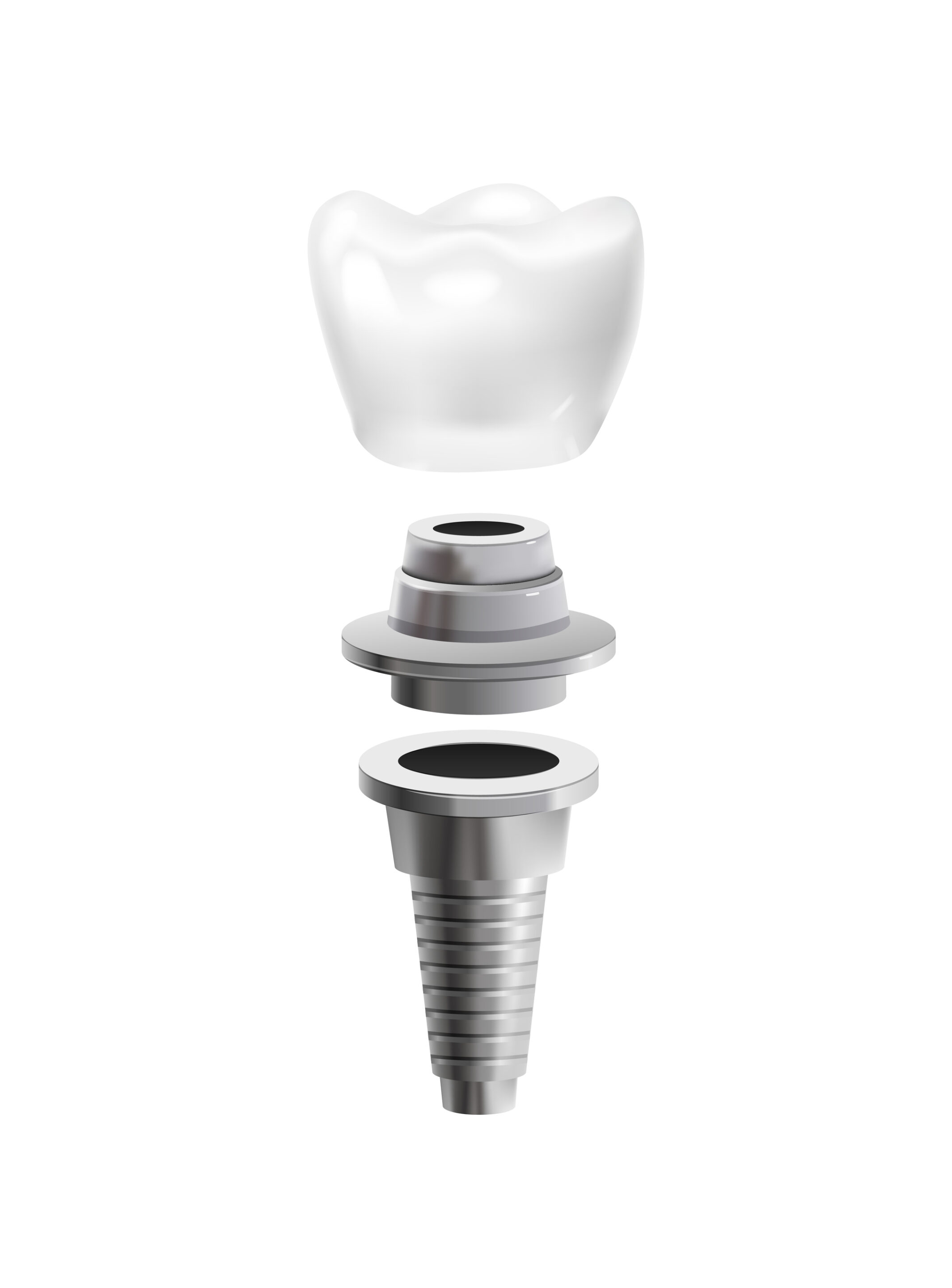 Dental crown on implant
