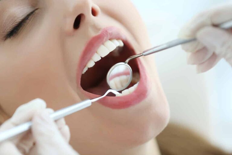Dental Cleaning in South San Francisco