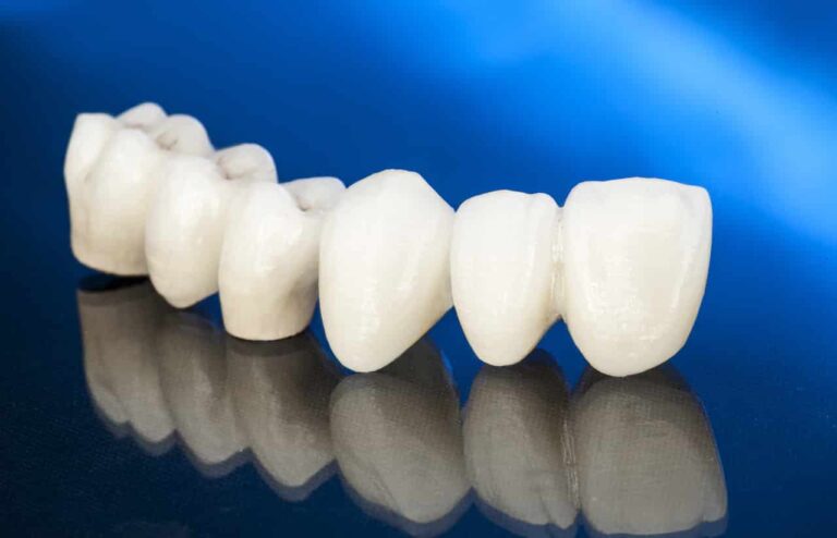 Dental Services 76 Full Mouth Reconstruction in South San Francisco
