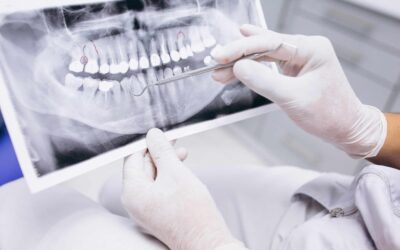 The Differences Between Dental and Medical Care