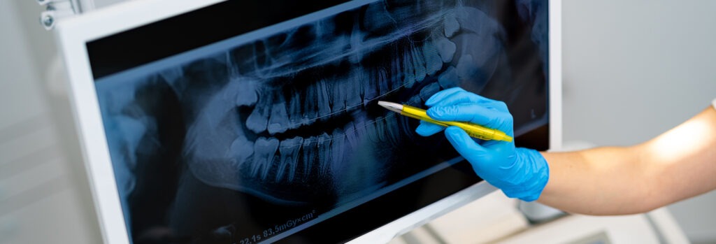 Dentistry vs Medicine: the Differences Between Dental and Medical Care