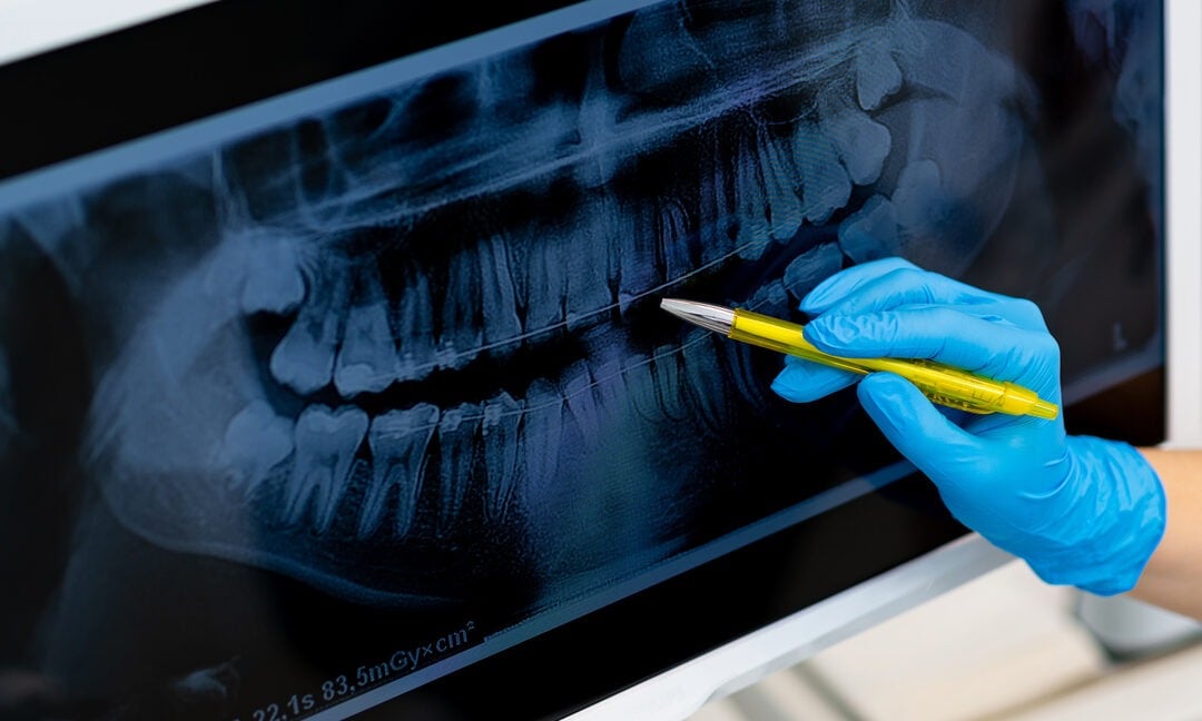 Dentistry vs Medicine: the Differences Between Dental and Medical Care