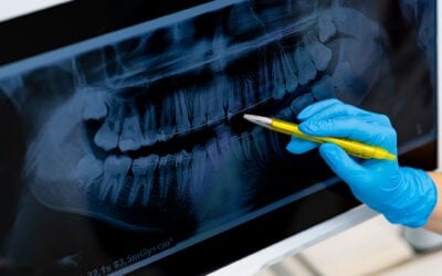 Dentistry vs Medicine: the Differences Between Dental and Medical Care