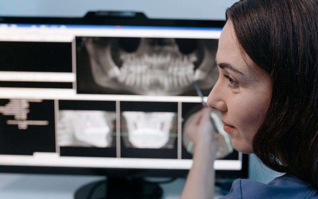 AI Is Now Reading Your Dental X-Rays — Here’s What That Means for You