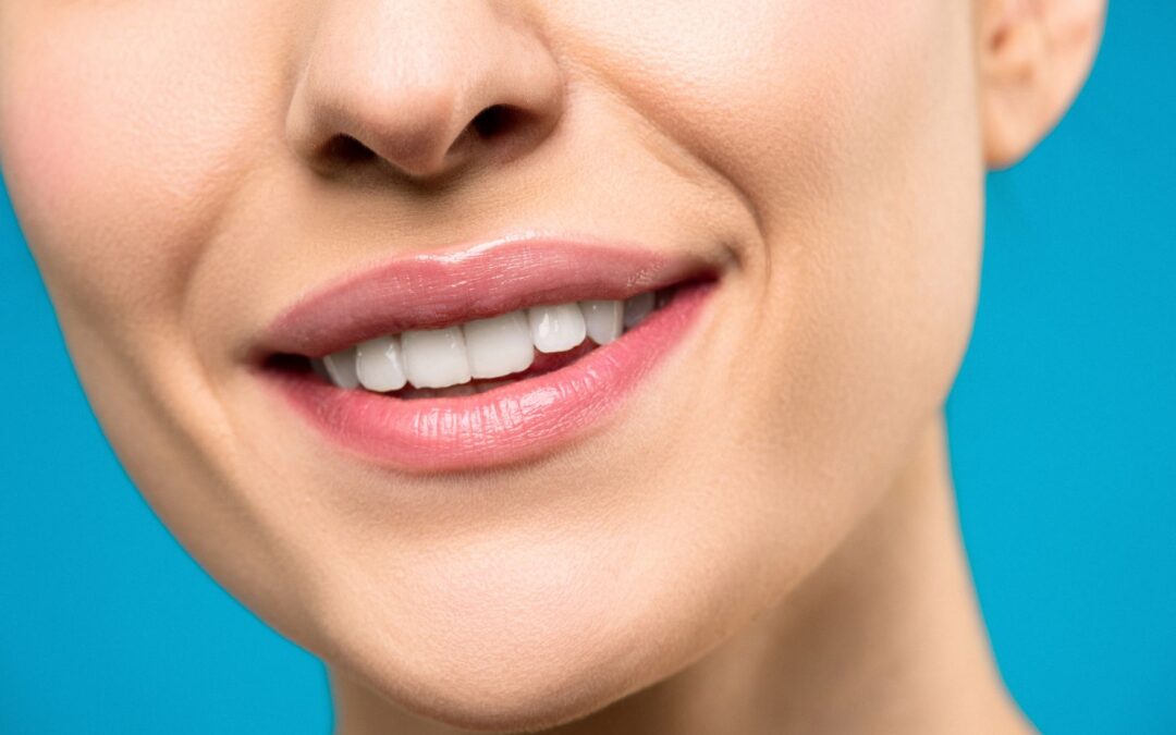 What Are “Turkey Teeth”? The Viral Dental Trend Explained — and What to Know Before You Go