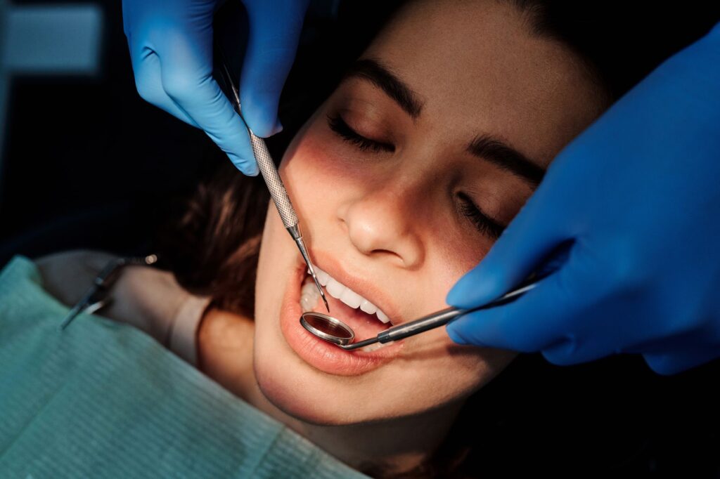 What Does a Cavity Look Like? A Visual Guide to Every Stage