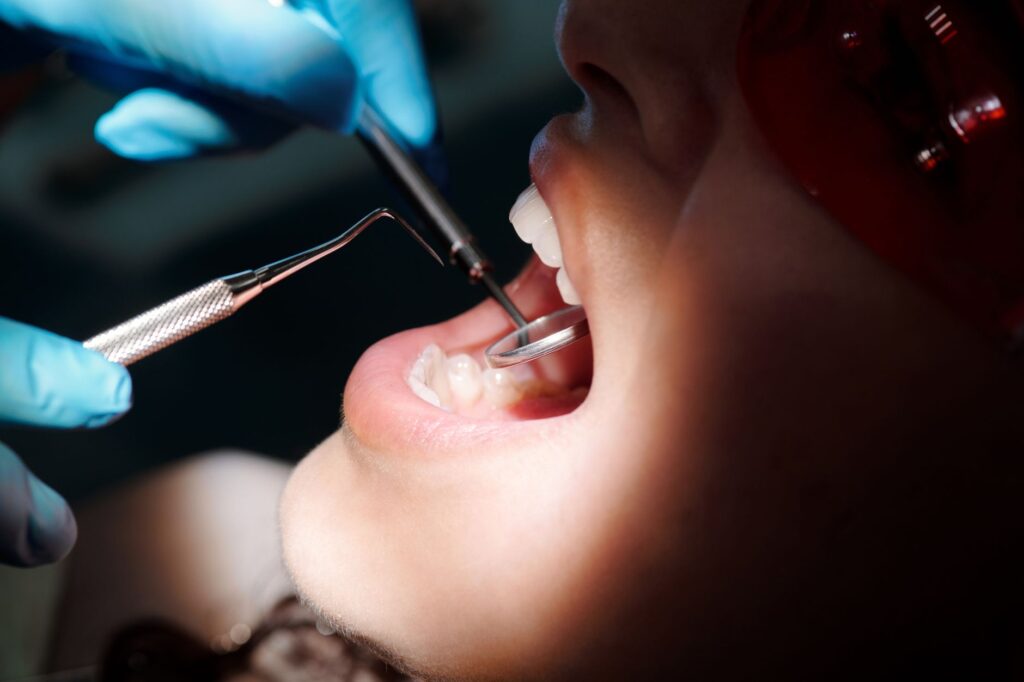 Scientists Find a Simple Way to Stop Cavities Without Drilling: What the Research Really Shows