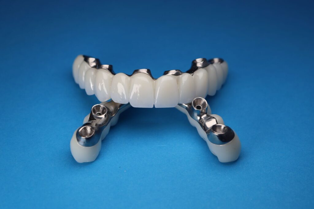 Full Mouth Dental Implants Cost: What You’ll Actually Pay in 2026 (and Why the Price Varies So Much)