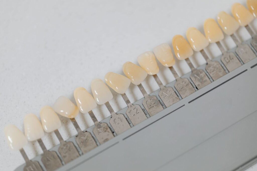 Composite Veneers vs. Porcelain Veneers: Which Is Right for Your Smile?