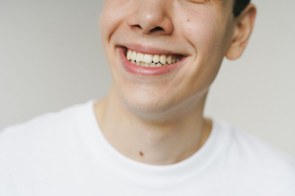 David Beckham’s Smile Makeover: What His Transformation Teaches You About Veneers vs. Whitening