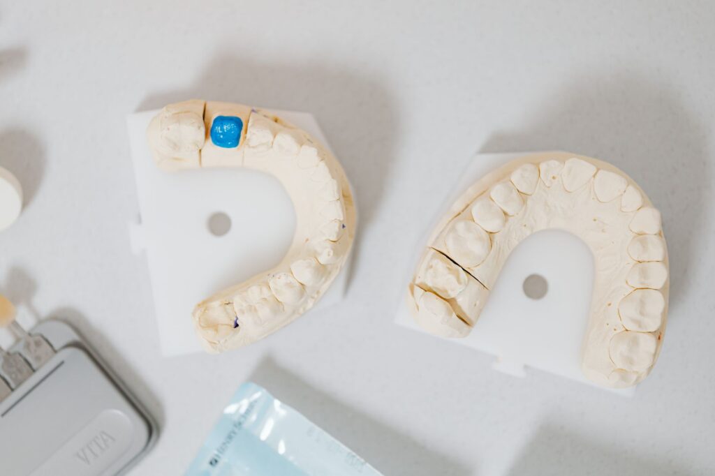 3D-Printed Crowns vs. CEREC Same-Day Crowns: Which Is Right for Your Tooth?